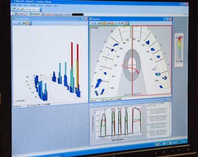 Shown here is a digital readout of force distributions clearly showing imbalances on one side.